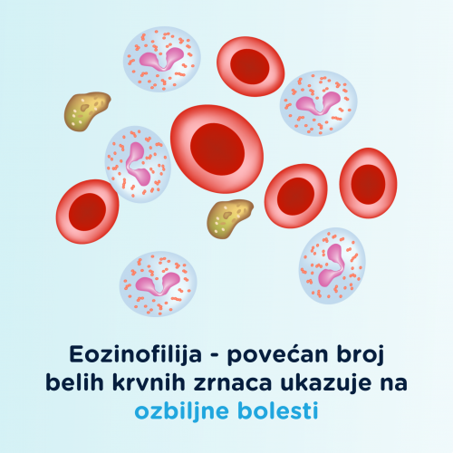 Eozinofilija – povećan broj belih krvnih zrnaca
